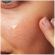 CeraVe Blemish Control Gel Ενυδατικό Τζελ Προσώπου για Δέρμα με Ατέλειες & Ακμή 40ml