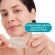Compeed Detergenti Επιθέματα Καθαρισμού για Σπυράκια 7 τμχ