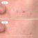 Novexpert Trio Zinc Clear Skin Peeling Προσώπου κατά των Ατελειών για Κανονικό έως Λιπαρό Δέρμα 30 ml