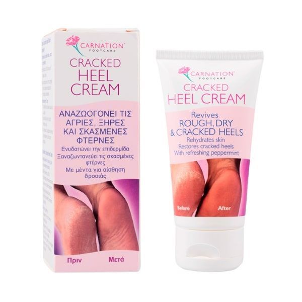 Carnation Cracked Heel Cream Κρέμα για τις Σκασμένες & Ξηρές Φτέρνες 50ml