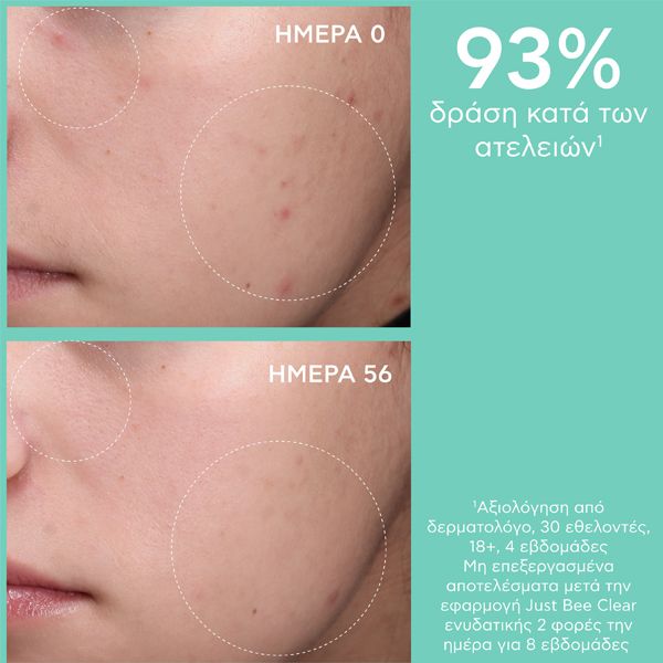 Apivita Just Bee Clear Κρέμα-Gel κατά των Ατελειών 40 ml