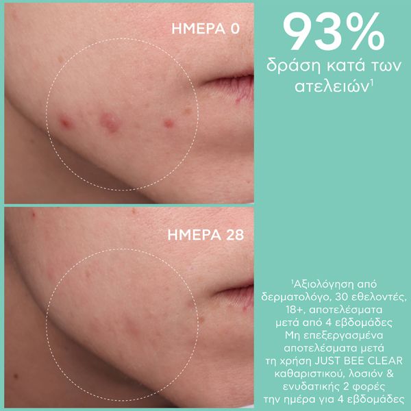 Apivita Just Bee Clear Λοσιόν Σύσφιγξης Πόρων 200 ml