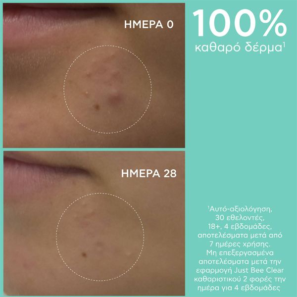Apivita Just Bee Clear Gel Καθαρισμού για Λιπαρή Επιδερμίδα με Τάση Ακμής 200 ml