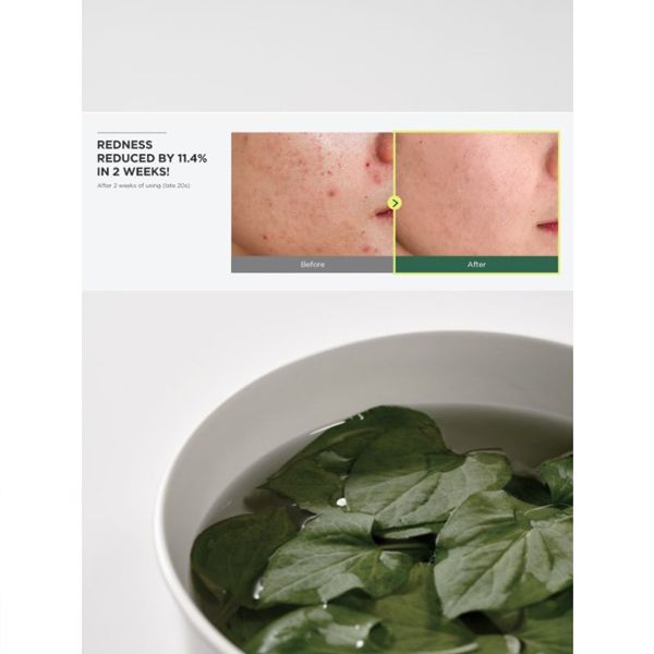 Korean Anua Heartleaf 77% Soothing Toner 500 ml