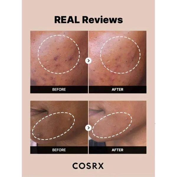 COSRX The Alpha Arbutin 2 Discoloration Care Serum Ορός για Πανάδες και Δυσχρωμίες 50 ml