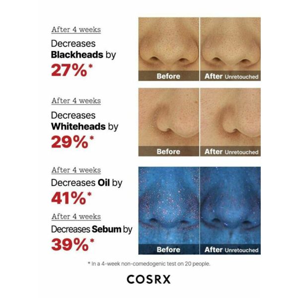 COSRX The AHA 2 BHA 2 Blemish Treatment Serum Ορός με Οξέα για Τοπική Χρήση 50 gr