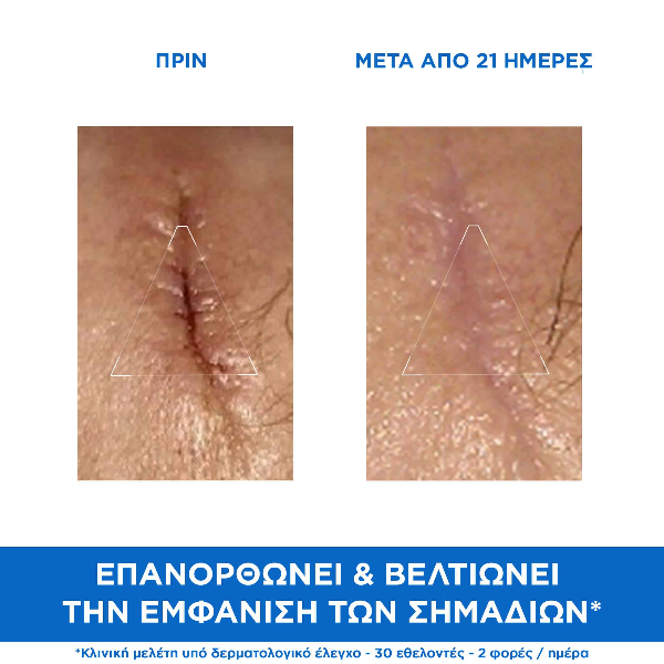 Uriage Bariederm Cica Καταπραϋντική & Αναπλαστική Κρέμα Προσώπου, Σώματος για Ερεθισμένο Δέρμα 40 ml