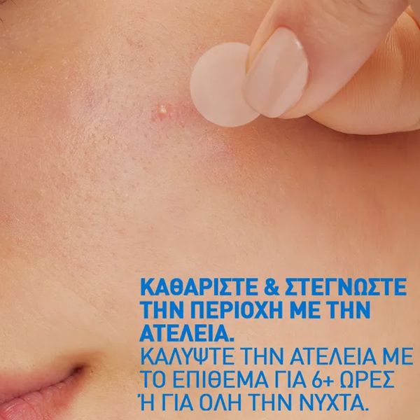 Blemish Barrier Patches Επιθέματα Ακμής για Ατέλειες Προσώπου 22 τμχ
