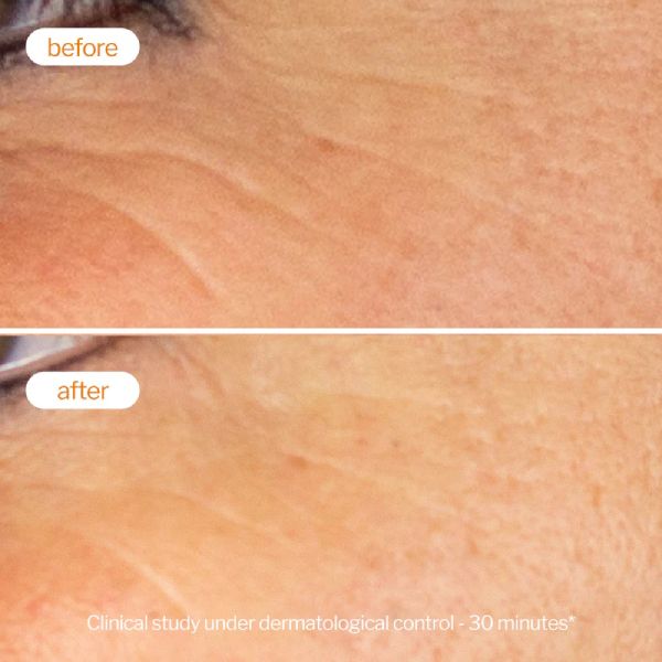 Novexpert Booster Προσώπου με Βιταμίνη C 30 ml