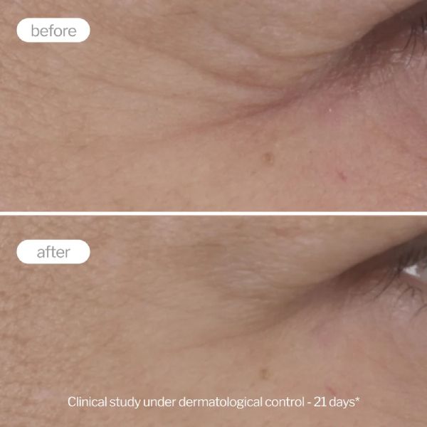 Novexpert Pro Collagen The Expert Κρέμα Ματιών Αντιγήρανσης 15 ml