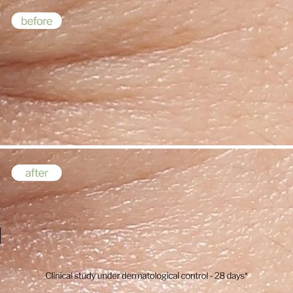 Novexpert Polyphenols Booster Serum Προσώπου Λευκαντικός με Πράσινο Τσάι κατά των Κηλίδων 30 ml