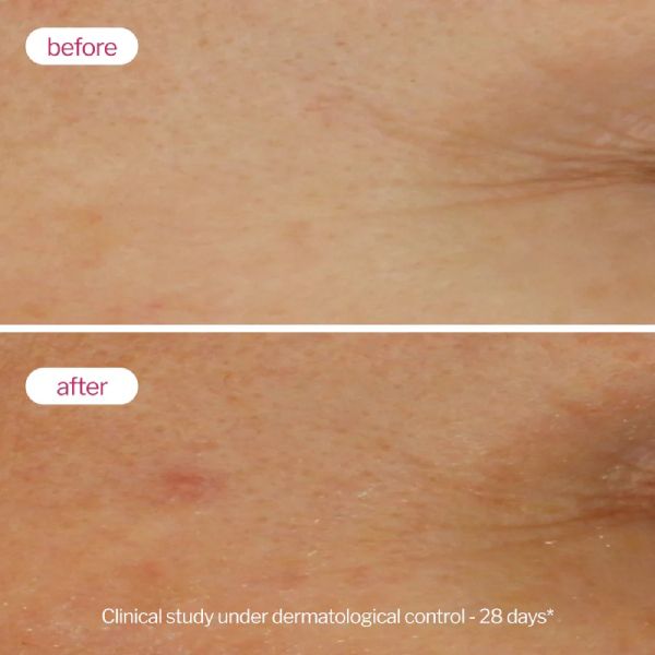 Novexpert The Repulp Booster Serum Αντιγήρανσης Προσώπου με Υαλουρονικό Οξύ για Μικτό, Κανονικό και Ξηρό Δέρμα 30 ml