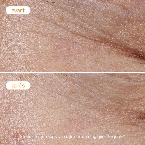 Novexpert Κρέμα Προσώπου με Βιταμίνη C Ελαφριάς Υφής 40 ml