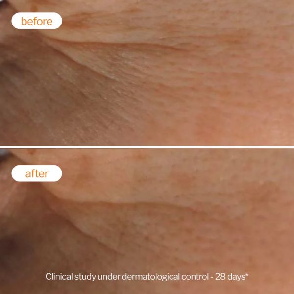 Novexpert Peeling Προσώπου για Λάμψη με Βιταμίνη C για Κανονικό έως Λιπαρό Δέρμα 30 ml