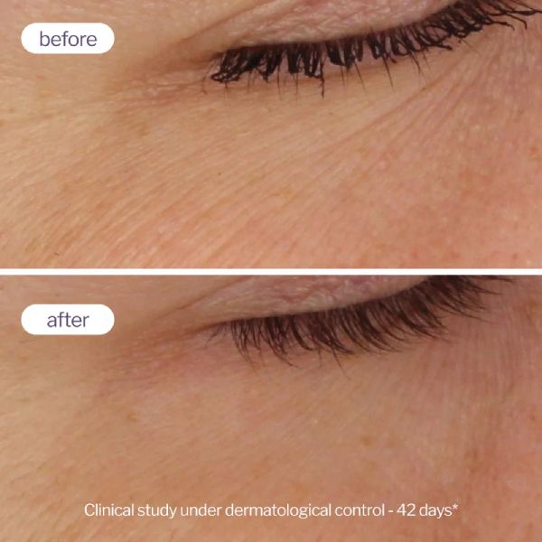 Novexpert Pro Retinol Διπλό Booster Serum Προσώπου με Ρετινόλη 30 ml